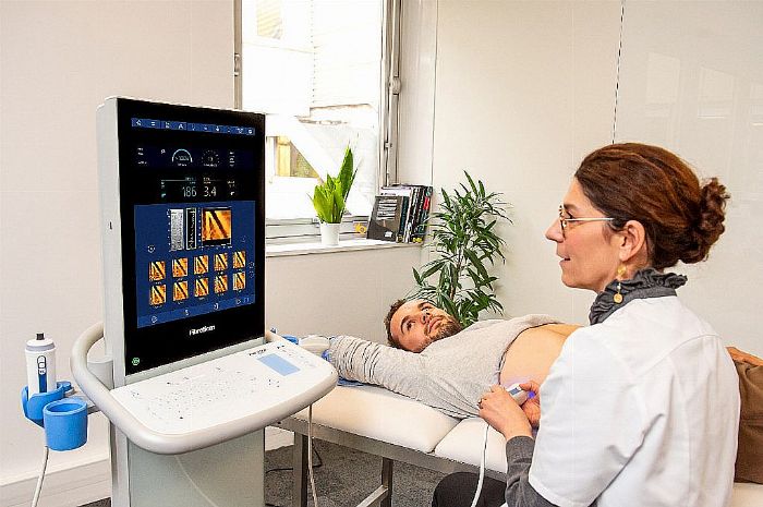 FibroScan®ȫwS\˜ʣ؇HJCRrֵct(y)ԺQ߉݋
